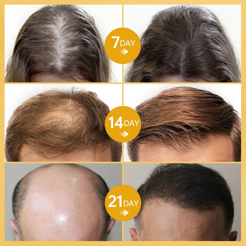 Natural Hair Essential Oil